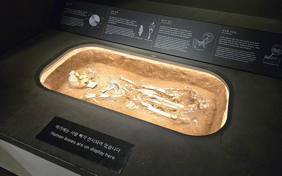 Human bones are displayed.